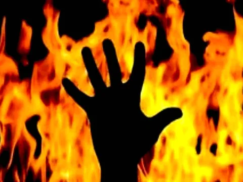 पोल से बांधकर चमड़ी उधेड़ दो, चाचा बनाना चाहता था संबंध… बिहार में महिला को मिली तालिबानी सज़ा, जानें पूरा मामला