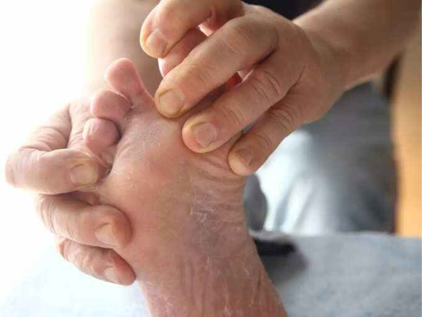 Health Tips: इन 5 चीजों से नींद न आने की बीमारी करें दूर, अपनाए और ये 5 उपाय