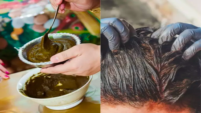 इस विटामिन की कमी के कारण सर्दियों में सबसे ज्यादा झड़ते हैं बाल, जानिए इसका सरल समाधान