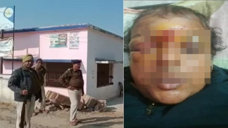 76 दिन बाद आज स्वदेश लौटेंगे लालू प्रसाद यादव, बेटी रोहिणी ने दिया अपडेट