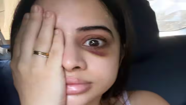 Urfi Javed पर फिर से हुआ वार, इस एक्टर ने बताया एक्ट्रेस को किन्नर, बोले- ‘मेरे पास सबूत भी हैं’