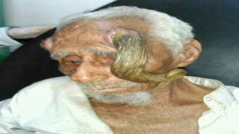 पैरासिटामॉल समेत ये 50 दवाइयां खाईं तो होगा बड़ा नुकसान! क्वालिटी टेस्ट में हुईं फेल