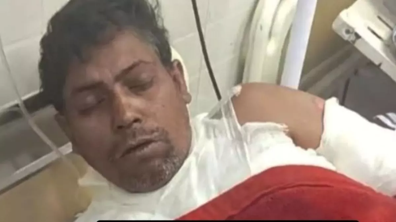 महिला को पुरानी रंजिश के चलते जलाया जिंदा, शर्म की हदें पार, पढ़कर खौल उठेगा खून