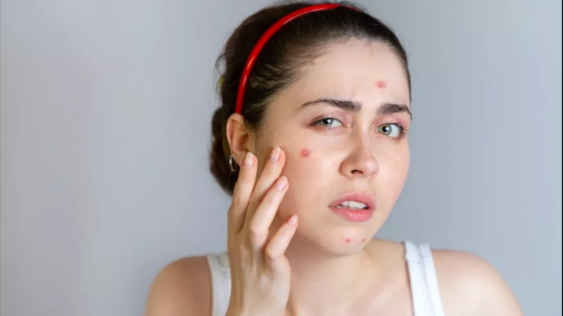 Beauty Tips: लाना चाहते हैं चेहरे की खोई हुई चमक वापस, तो करें ये बेहद असरदार उपाय