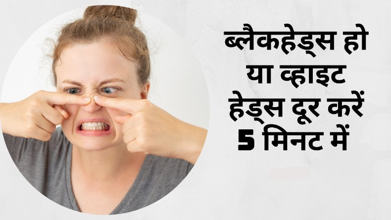 गर्मियों में इस तरह लगाएं मुल्तानी, जानें 5 तरीके, जिनसे मिलेगी मुलायम और चमकदार त्वचा
