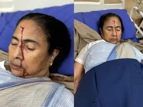 टीएमसी नेता और पश्चिम बंगाल की सीएम ममता बनर्जी को आई गंभीर चोट, अस्पताल में भर्ती