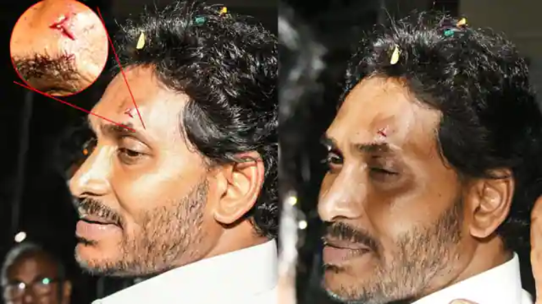 Andhra Pradesh: आंध्र प्रदेश के सीएम जगन मोहन रेड़्डी पर पत्थर से हमला, पीएम मोदी ने जाहिर की चिंता
