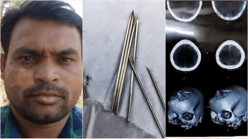 काले जादू के चक्कर में लड़की के सिर में चुभोई 70 सुइयां, तांत्रिक गिरफ्तार
