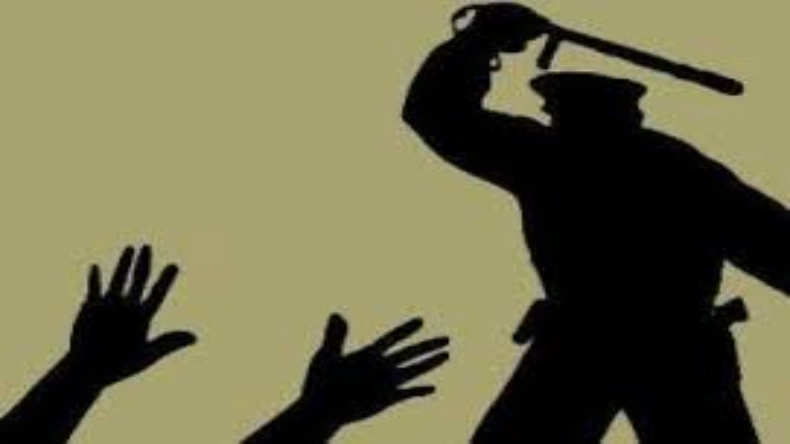 ये मॉडल इस जगह के बालों की है दिवानी, शेव बस… फॉलोअर्स हो जाते है परेशान