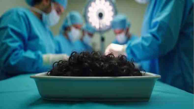पेट में दर्द होने पर पहुंची अस्पताल, ऑपरेशन के बाद निकाले 2 Kg बाल