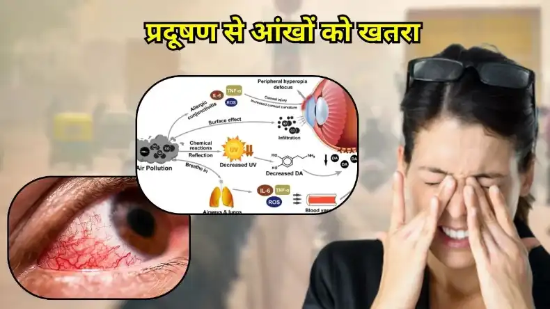 आंखों में पॉल्यूशन के कारण हो रही है दिक्कत, ये टिप्स देंगे जल्द राहत, अभी करें फॉलो