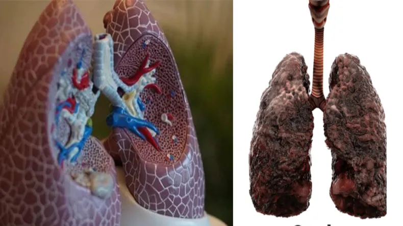 सालों से फेफड़ों में जमी गंदगी झट से होगी साफ, पानी में मिलाकर पिए ये चीज, शरीर को मिलेगा नया जीवन