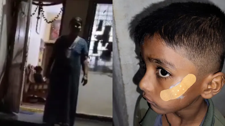 बच्चे के जख्मों पर नर्स ने भर दी feviquick, सर्जरी के बाद किया ऐसा हाल, हुई सस्पेंड