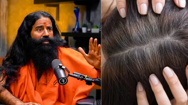 कम उम्र में सफ़ेद हो गए बाल? बाबा रामदेव के इस 5 तरीके से तुरंत काले हो जाएंगे सफ़ेद बाल