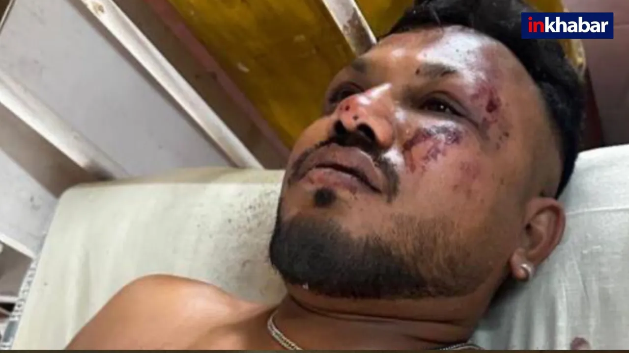 Ahmedabad Plane Crash : ‘चारों ओर लाशें ही लाशें, मैं डर गया…’ विश्वाश कुमार रमेश ने दी मौत को मात, बताया आखिर कैसे बचाई खुद की जान?
