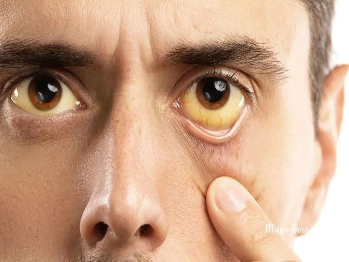 Vitamin B12 Deficiency: आपको शरीर में दिख रहे हैं ये 5 लक्षण? हो सकती है इस विटमिन की कमी, जानें कैसे करें दूर